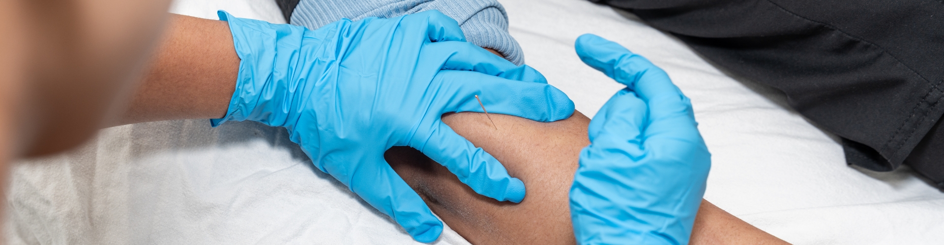 Dry Needling